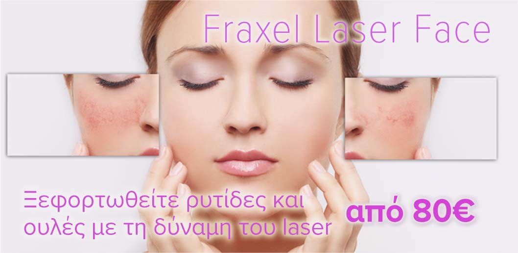 προσφορά-fraxel-laser-face-δερματολόγος-αφροδισιολόγος-ατζάρα-μαργαρίτα-αθήνα
