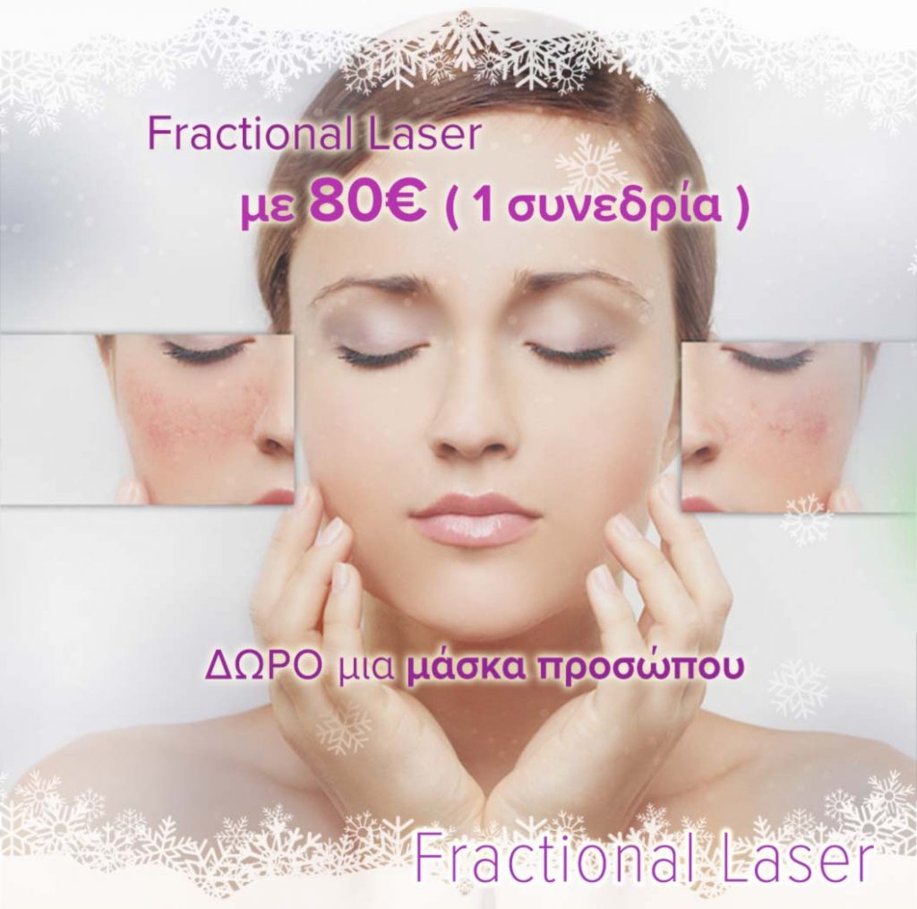 προσφορά-fractional-laser-προσώπου-δερματολόγος-αφροδισιολόγος-ατζάρα-μαργαρίτα-αθήνα